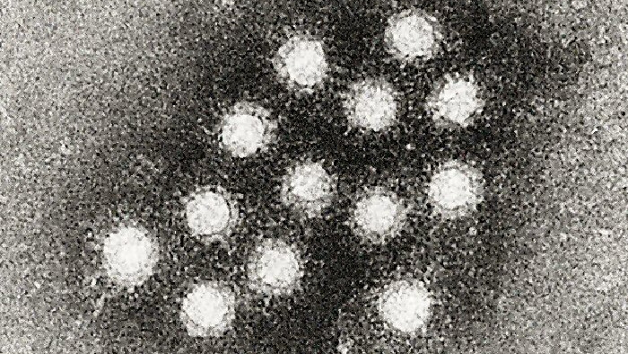 V Novom Meste nad Váhom potvrdili hygienici epidémiu vírusovej hepatitídy typu A